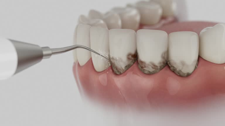 Trusted Emergency Dentist service in Chesnut Hill, PA - Dentist Open Now